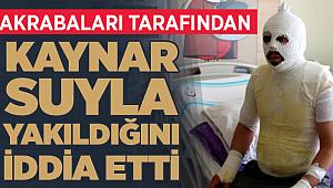 Akrabaları tarafından kaynar suyla yakıldığını iddia etti